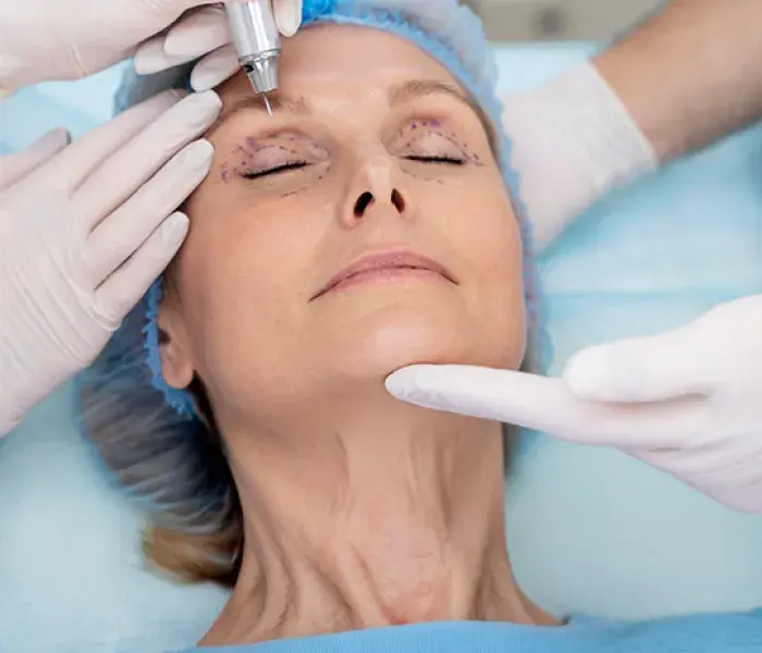 DPP: Cirugía plástica ocular y reconstructiva de párpados, vía lagrimal y órbita 